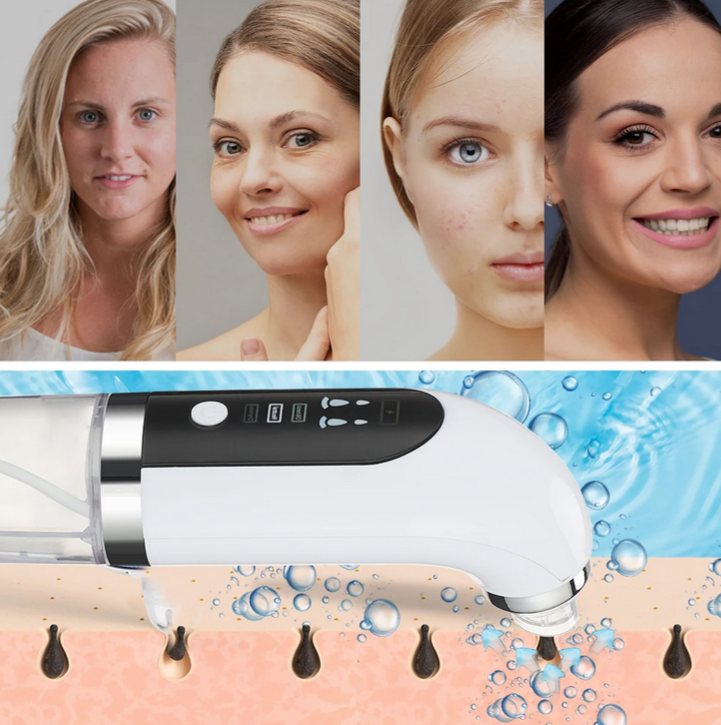 Hydrodermabrasion Blackhead Remover And Vacuum Pore Cleaner